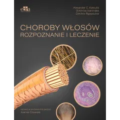 CHOROBY WŁOSÓW. ROZPOZNANIE I LECZENIE