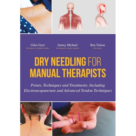DRY NEEDLING FOR MANUAL THERAPISTS