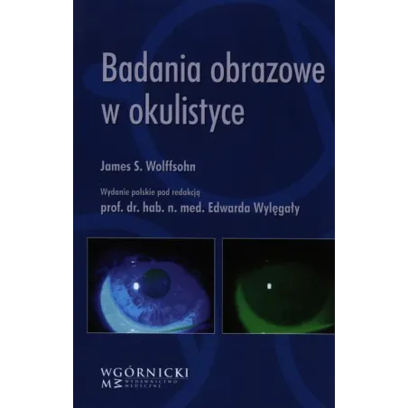 Badania Obrazowe W Okulistyce Badania Obrazowe W Okulistyce