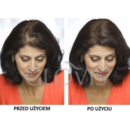 Odsiwiacz Zagęszczacz Włosów 2W1 Ciemny Brąz Glovis Concealer