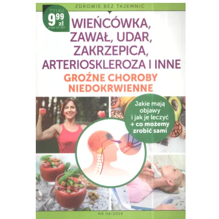 Wieńcówka, Zawał, Udar, Zakrzepica, Arterioskleroza I Inne Groźne Choroby Niedokrwienne Wieńcówka, Zawał, Udar, Zakrzepica, Arterioskleroza I Inne Groźne Choroby Niedokrwienne