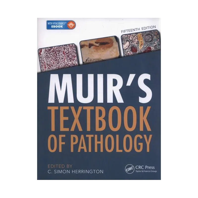 MUIRS TEXTBOOK OF PATHOLOGY 1 C. Simon Herrington - CRC Press
