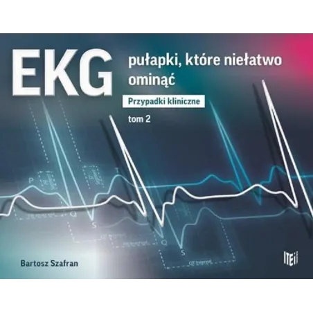 Ekg Pułapki, Które Niełatwo Ominąć Przypadki Kliniczne 2 Bartosz Szafran Ekg Pułapki, Które Niełatwo Ominąć Przypadki Kliniczne 2 Bartosz Szafran