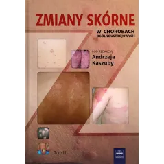 ZMIANY SKÓRNE W CHOROBACH OGÓLNOUSTROJOWYCH 3 Andrzej Kaszuba - CZELEJ