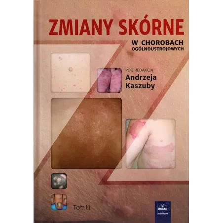 Zmiany Skórne W Chorobach Ogólnoustrojowych 3 Andrzej Kaszuba