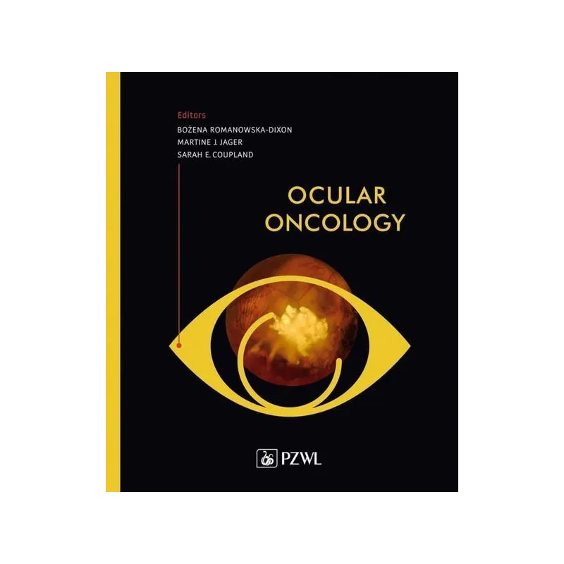 OCULAR ONCOLOGY Bożena Romanowska-Dixon, Martine J. Jager, Sarah E. Coupland - Wydawnictwo Lekarskie PZWL