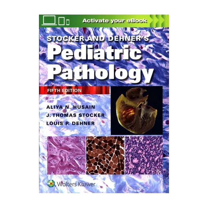 STOCKER AND DEHNERS PEDIATRIC PATHOLOGY Aliya N. Husain - Wolters Kluwer