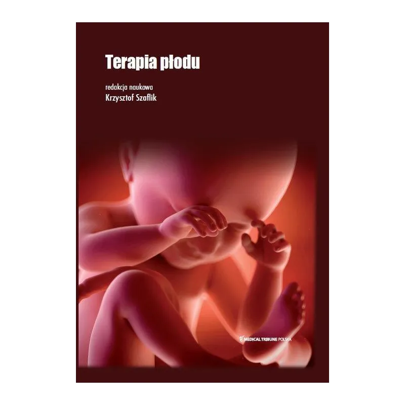TERAPIA PŁODU Krzysztof Prof Szaflik - Medical Tribune Polska
