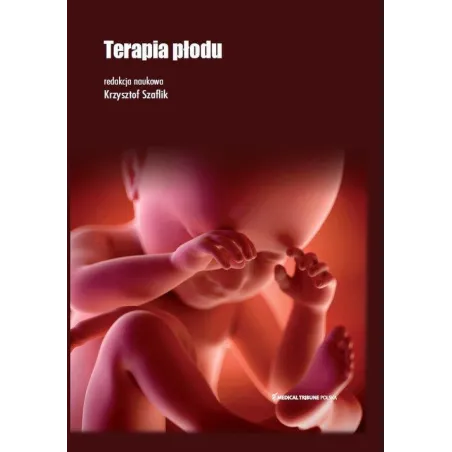 TERAPIA PŁODU Krzysztof Prof Szaflik - Medical Tribune Polska