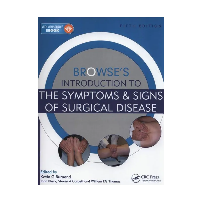 BROWSES INTRODUCTION TO THE SYMPTOMS & SIGNS OF SURGICAL DISEASE Steven A. Corbett - CRC Press