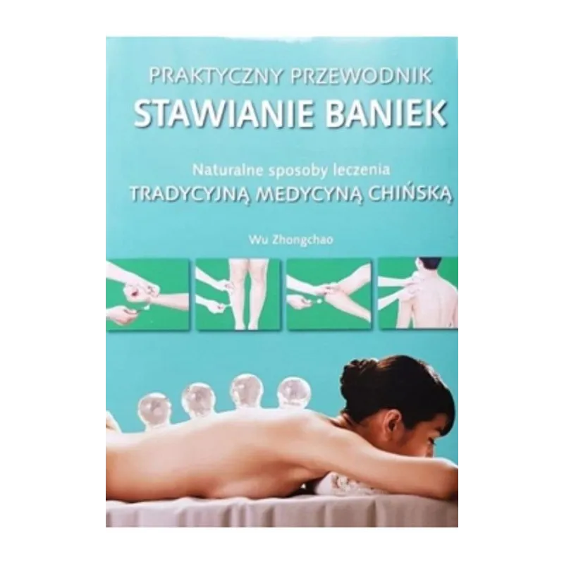 STAWIANIE BANIEK. PRAKTYCZNY PRZEWODNIK. NATURALNE SPOSOBY LECZENIA TRADYCYJNĄ MEDYCYNĄ CHIŃSKĄ - Olesiejuk