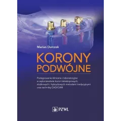 KORONY PODWÓJNE POSTĘPOWANIE KLINICZNE I LABORATORYJNE W WYKONAWSTWIE KORON TELESKOPOWYCH STOŻKOWYCH I HYBRYDOWYCH ME... Durczok