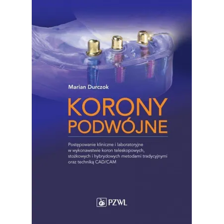 KORONY PODWÓJNE POSTĘPOWANIE KLINICZNE I LABORATORYJNE W WYKONAWSTWIE KORON TELESKOPOWYCH STOŻKOWYCH I HYBRYDOWYCH ME... Durczok