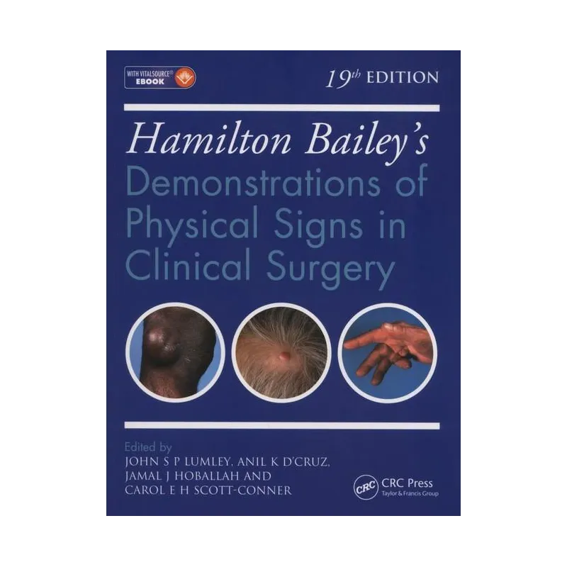 HAMILTON BAILEYS PHYSICAL SIGNS John S.P Lumley, Anil K. D'Cruz, Jamal J. Hoballah, Carol E.H. Scott-Connor