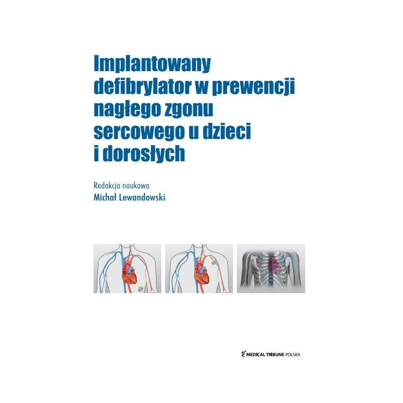 IMPLANTOWANY DEFIBRYLATOR W PREWENCJI NAGŁEGO ZGONU SERCOWEGO U DZIECI I DOROSŁYCH