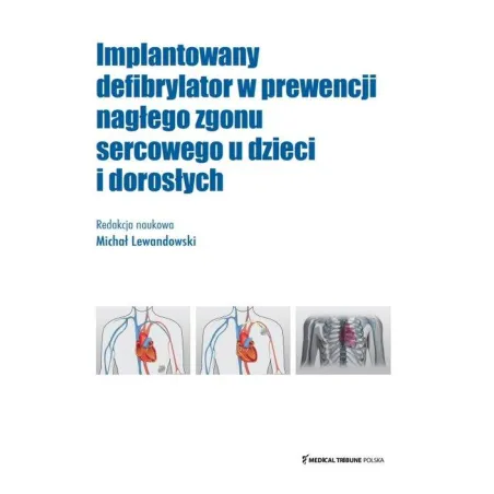 IMPLANTOWANY DEFIBRYLATOR W PREWENCJI NAGŁEGO ZGONU SERCOWEGO U DZIECI I DOROSŁYCH