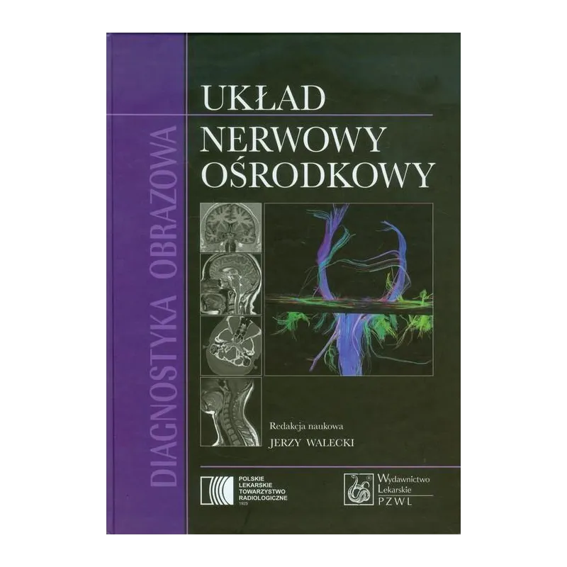 DIAGNOSTYKA OBRAZOWA UKŁAD NERWOWY OŚRODKOWY Jerzy Walecki - Wydawnictwo Lekarskie PZWL
