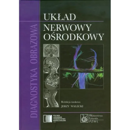 Diagnostyka Obrazowa. Układ Nerwowy Ośrodkowy Diagnostyka Obrazowa. Układ Nerwowy Ośrodkowy