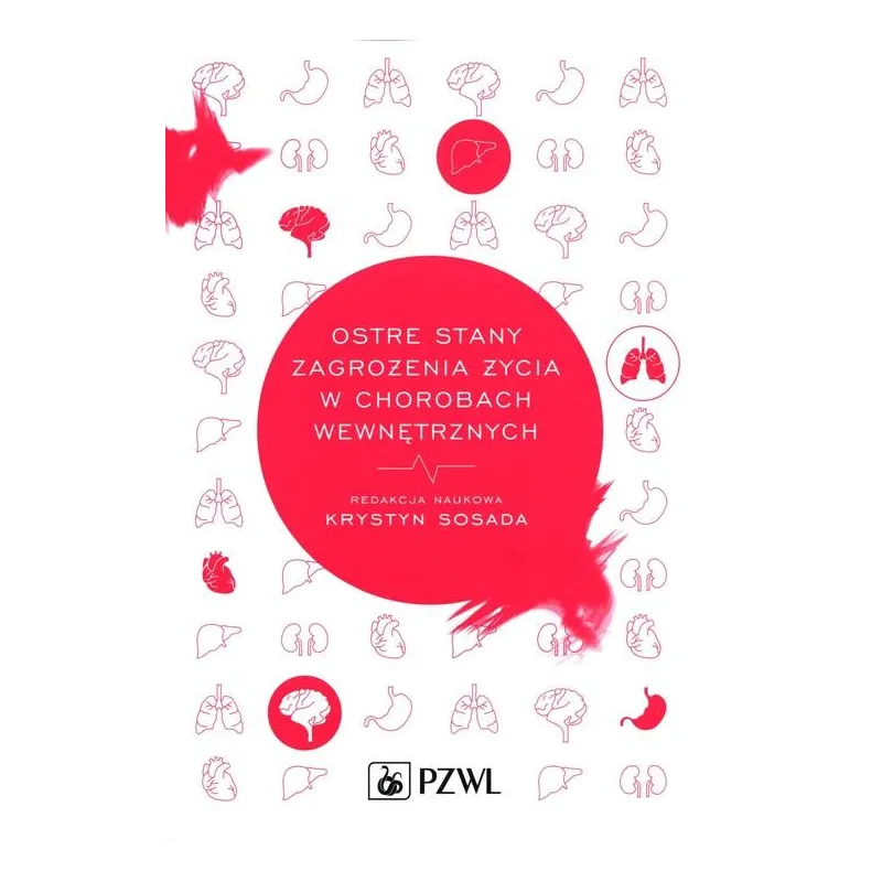 OSTRE STANY ZAGROŻENIA ŻYCIA W CHOROBACH WEWNĘTRZNYCH OSTRE STANY ZAGROŻENIA ŻYCIA W CHOROBACH WEWNĘTRZNYCH