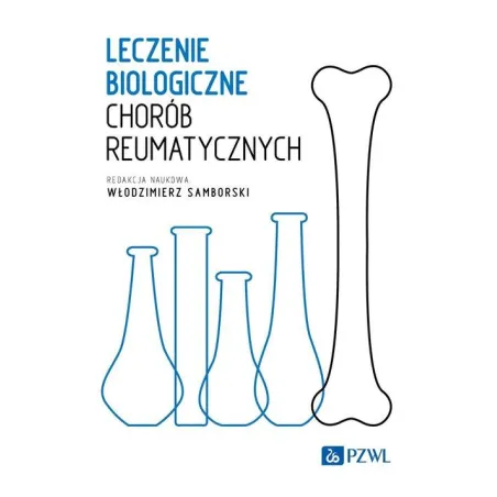 Leczenie Biologiczne Chorób Reumatycznych