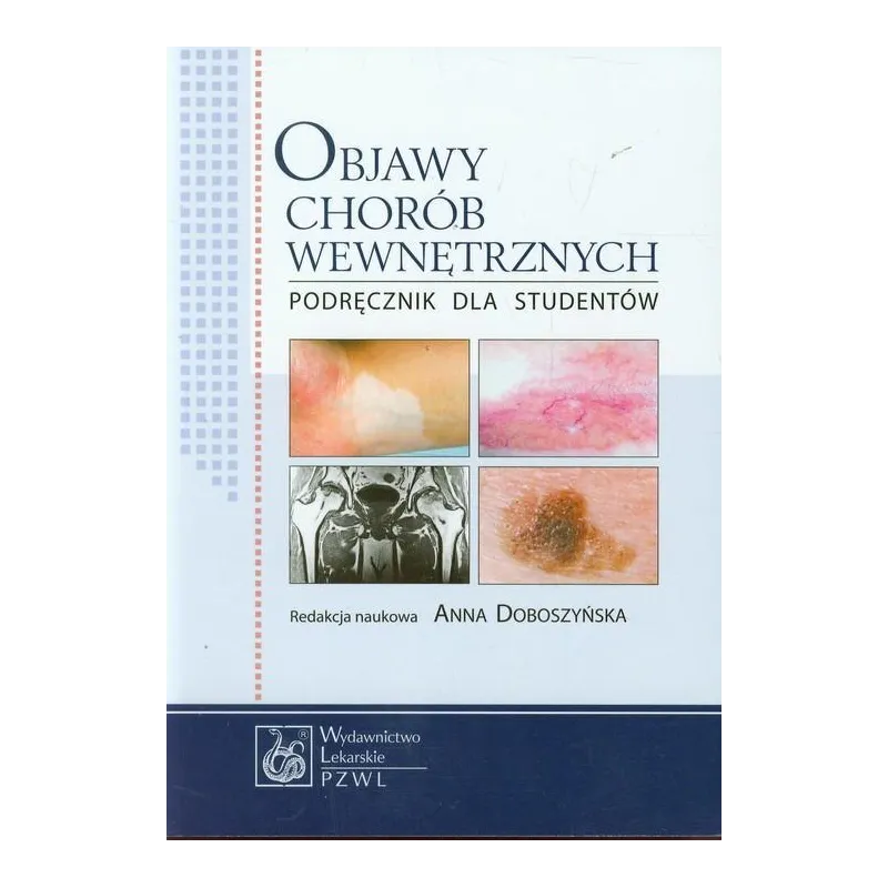 OBJAWY CHORÓB WEWNĘTRZNYCH PODRĘCZNIK DLA STUDENTÓW Anna Doboszyńska - Wydawnictwo Lekarskie PZWL