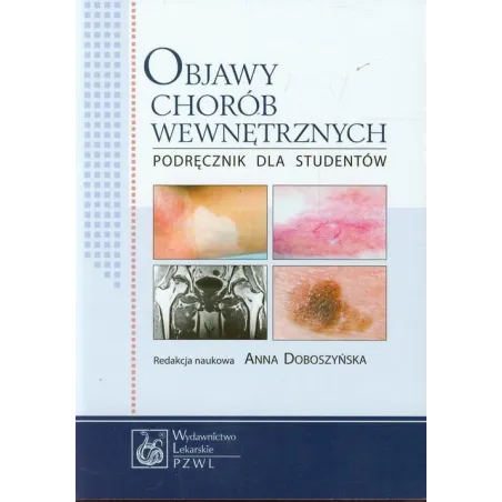 OBJAWY CHORÓB WEWNĘTRZNYCH PODRĘCZNIK DLA STUDENTÓW Anna Doboszyńska - Wydawnictwo Lekarskie PZWL