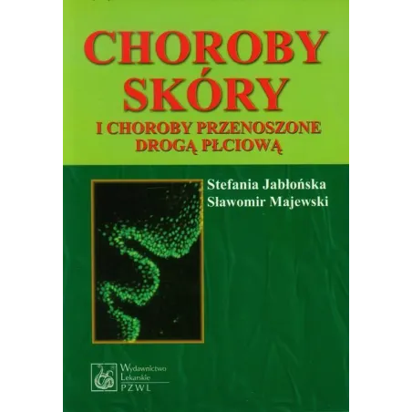 Choroby Skóry I Choroby Przenoszone Drogą Płciową Stefania Jabłońska, Sławomir Majewski