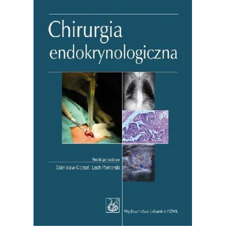 Chirurgia Endokrynologiczna