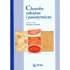 CHOROBY ZAKAŹNE I PASOŻYTNICZE