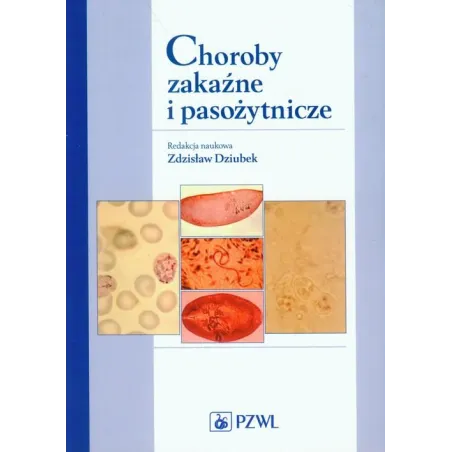 CHOROBY ZAKAŹNE I PASOŻYTNICZE