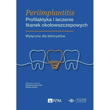 Periimplantitis Profilaktyka I Leczenie Tkanek Okołowszczepowych